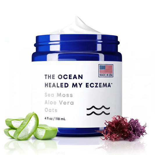 THE OCEAN HEALED MY ECZEMA PARA LAS MAMÁS QUE LE PONEN CREMA, CREMA Y MÁS CREMA Y LA MALDITA PICAZÓN NO PARA